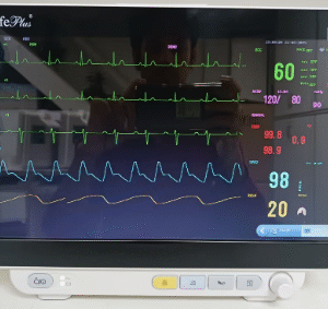 LifePlus Five Para Patient Monitor (LPM-914)
